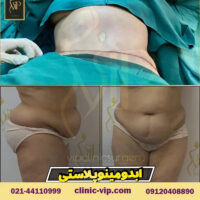 عمل پیکرتراشی شامل چه نواحی است؟